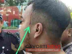Aniaya Wartawan Oknum Security Tri Setya Lencana Medan , Diminta Polisi Jerat Pelaku UU 40/1999 Subs Pasal 351 Jo Pasal 170 KUHPidana